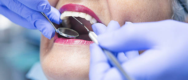 Best Emergency Treatment for Dental Infections or Abscesses in Grove City, PA